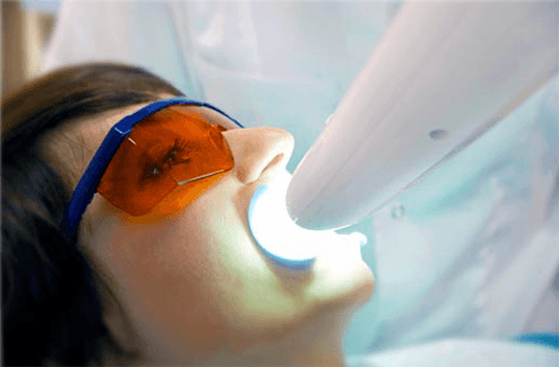 Understanding the Causes of Teeth Sensitivity Maidenhead