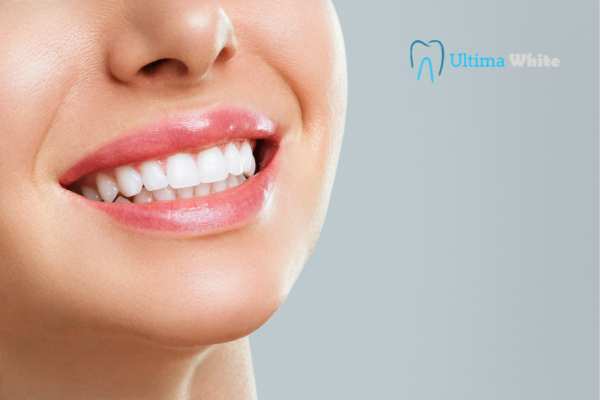 Common Mistakes That Can Ruin Your Whitening Results Maidenhead