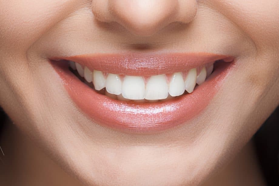 Smart Daily Habits to Protect Your Enamel Maidenhead