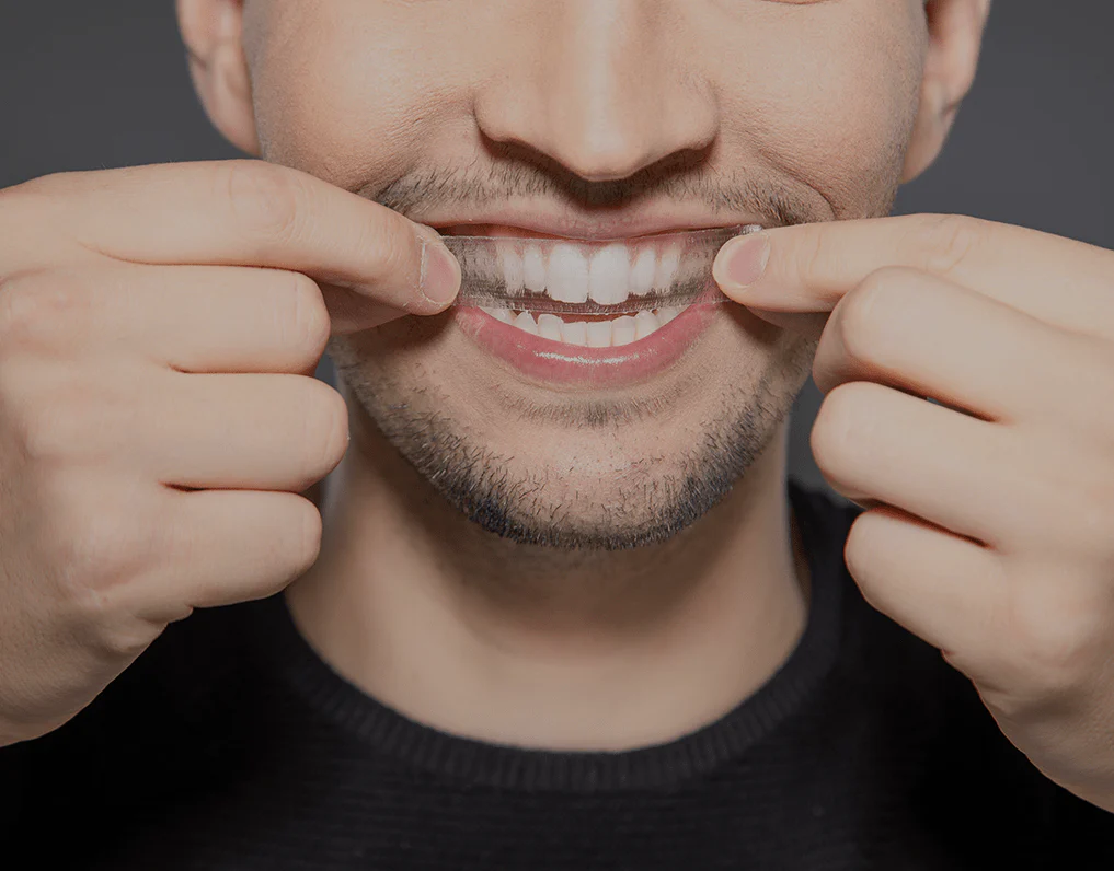 How Are Invisible Aligners Changing Orthodontic Treatments Maidenhead?