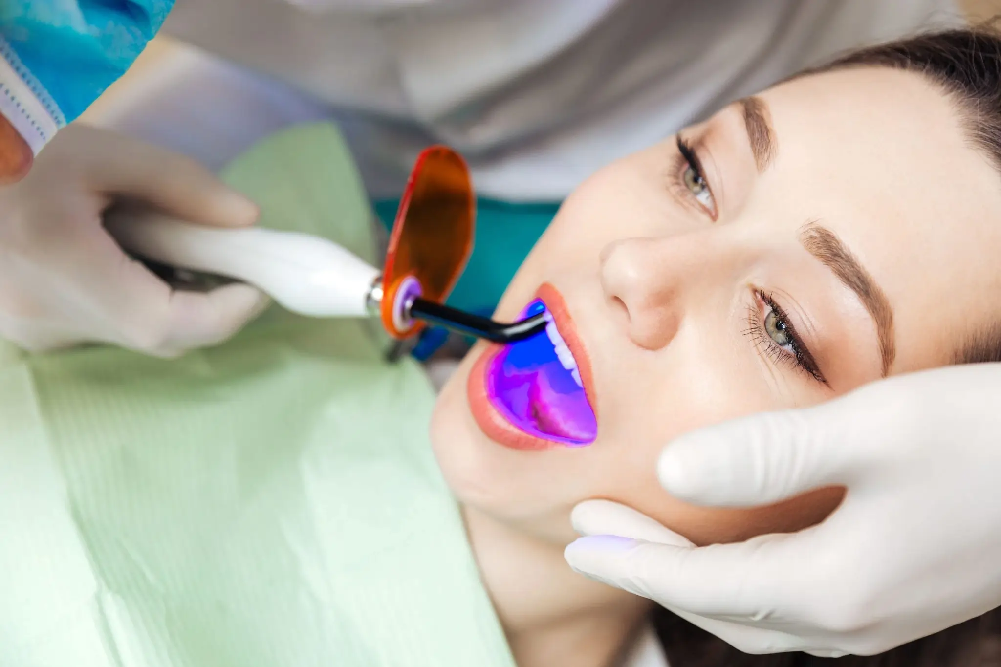 When Should You Stop DIY Whitening and Consider Professional Treatment Instead Maidenhead?