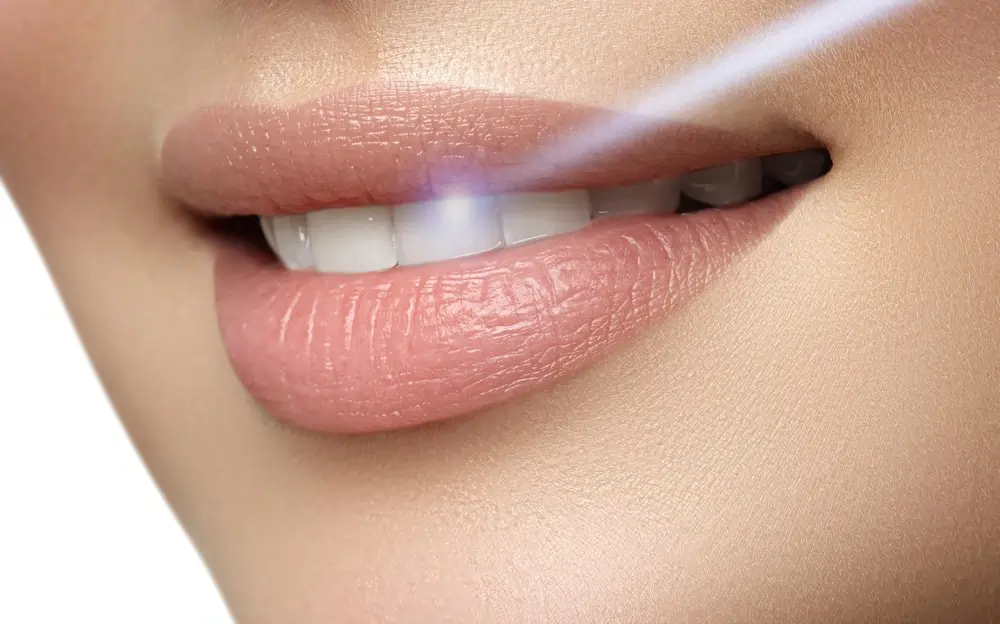 Understanding Teeth Whitening Risks and Results Maidenhead