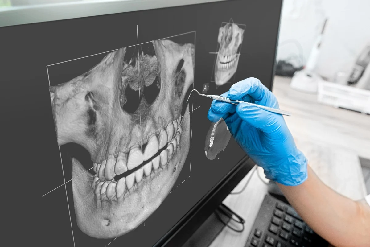 How Is AI Transforming Dental Treatment Planning Maidenhead?