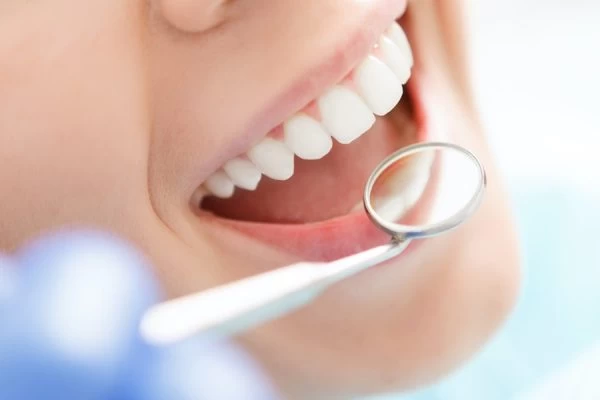How Much Fluoride Do You Really Need Maidenhead?