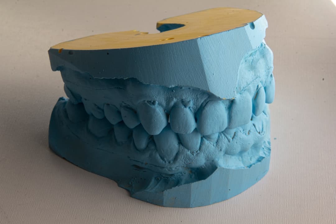 How Do Dental Implants Improve Jawbone Health and Oral Function Maidenhead?
