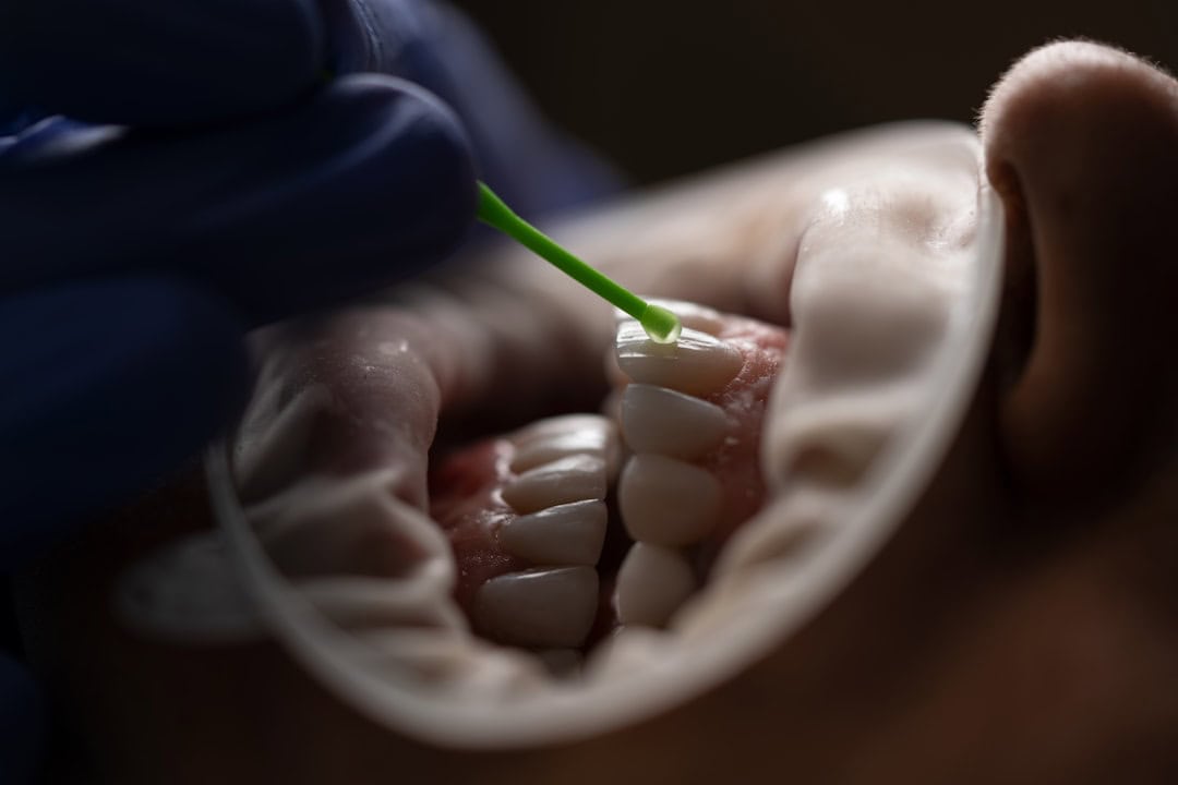 How Saliva Protects Your Teeth and Gums Maidenhead