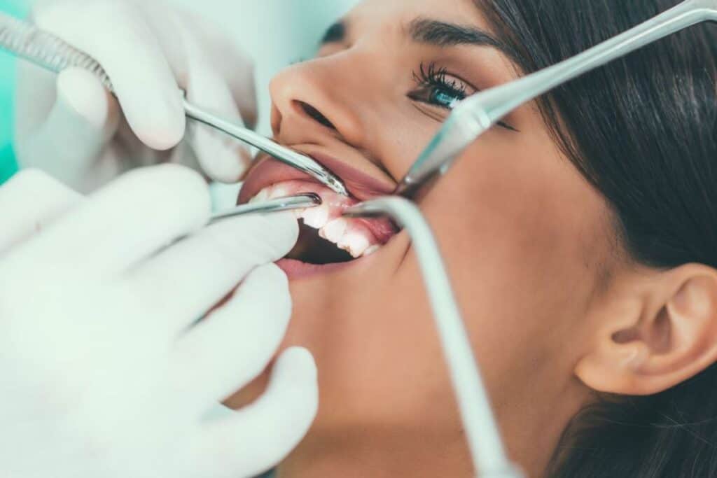 Braces Are Just for Kids – Myth or Reality Maidenhead