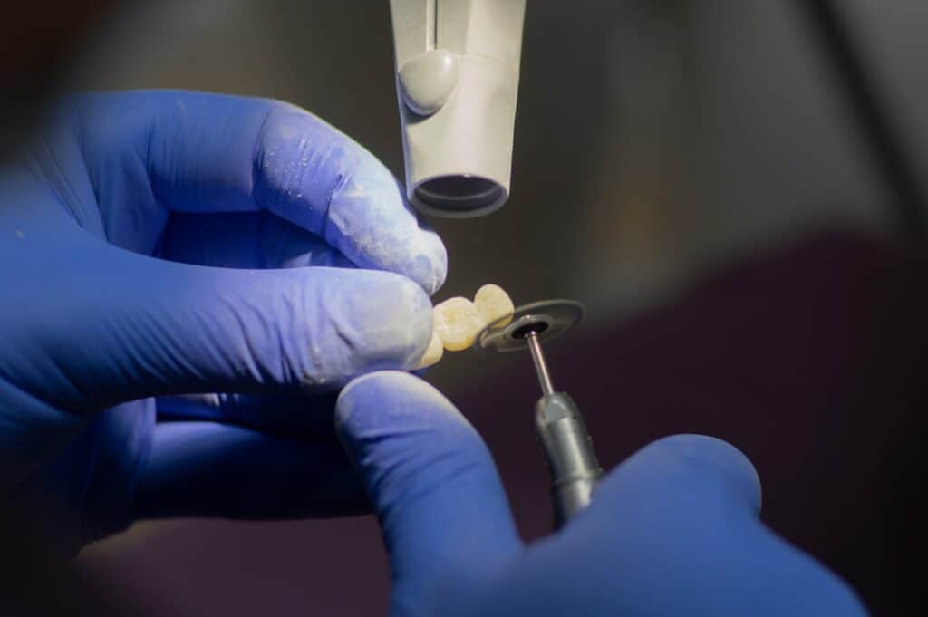 Customised Dental Solutions: Crowns, Aligners, and Implants Maidenhead